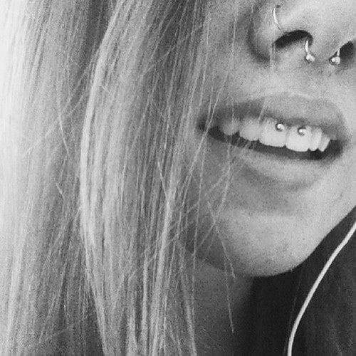 Septo & Smiley