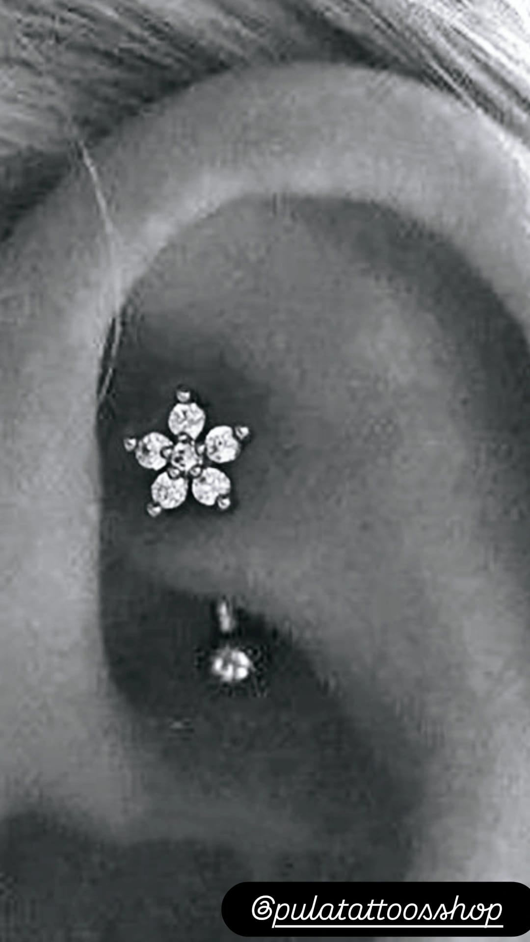 Cartilagem Floral